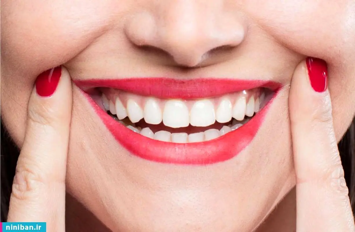 روکش تمام سرامیک دندان، تحقق لبخند رویایی
