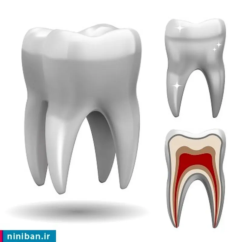 انواع درمان ریشه دندان کدام است؟