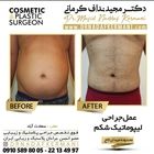 قیمت لیپوماتیک در سال 1404، مزایای آن را می‌دانید؟