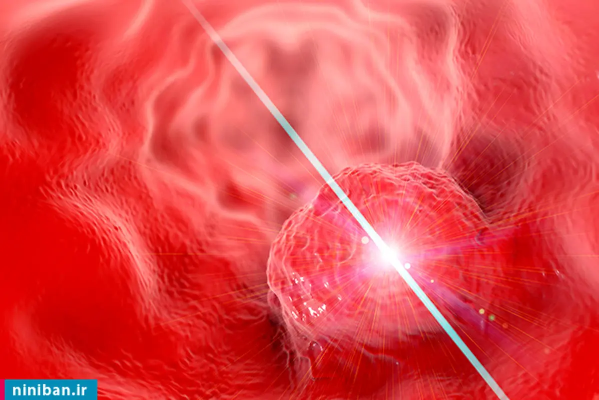 انواع لیزر درمانی کدام است؟