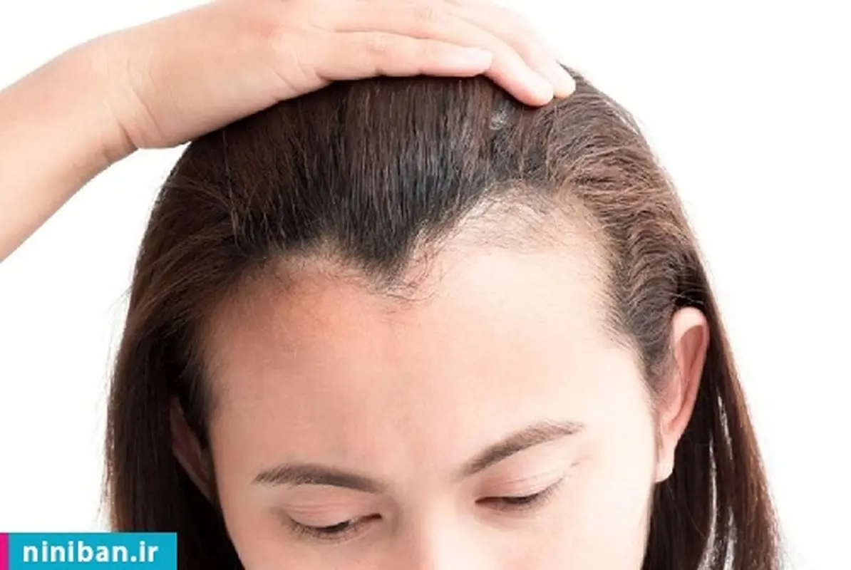 بهترین کلینیک تخصصی کاشت مو طبیعی