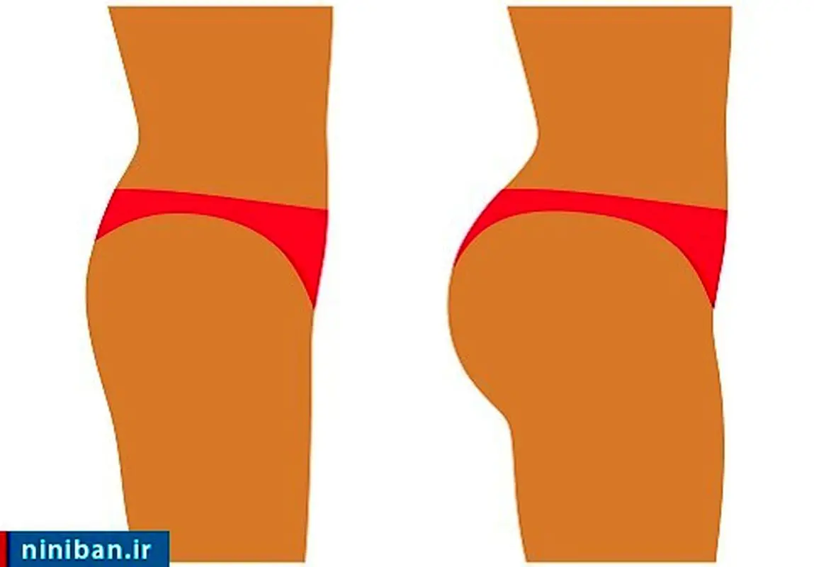 صفر تا صد تزریق چربی به باسن، چقدر مؤثره؟