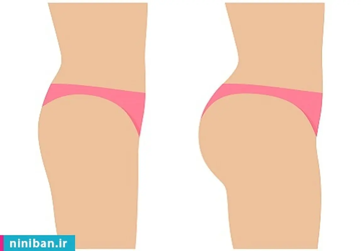 صفر تا صد تزریق چربی به باسن، چقدر مؤثره؟
