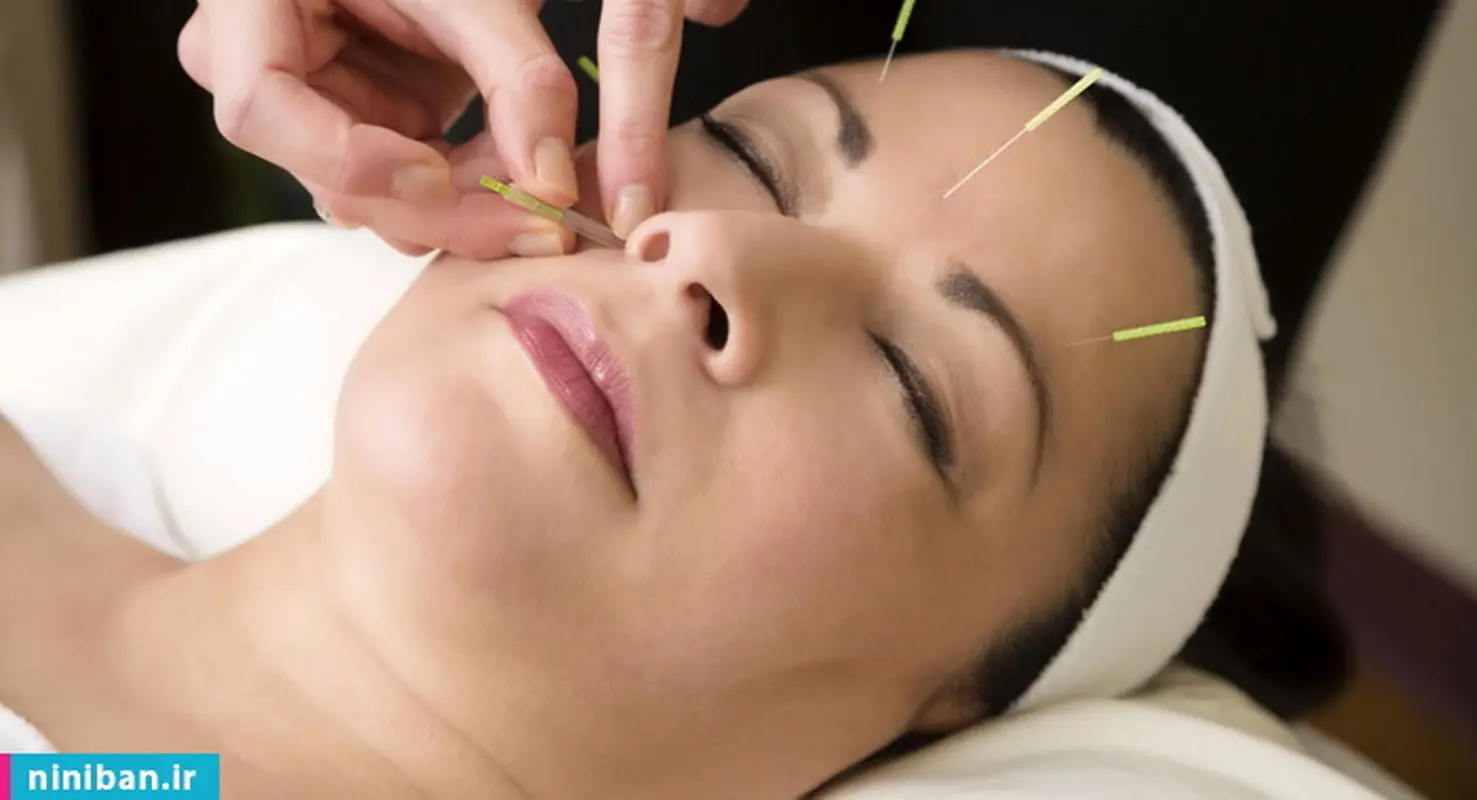 طب سوزنی چیست؟ درمان را به سوزن بسپارید