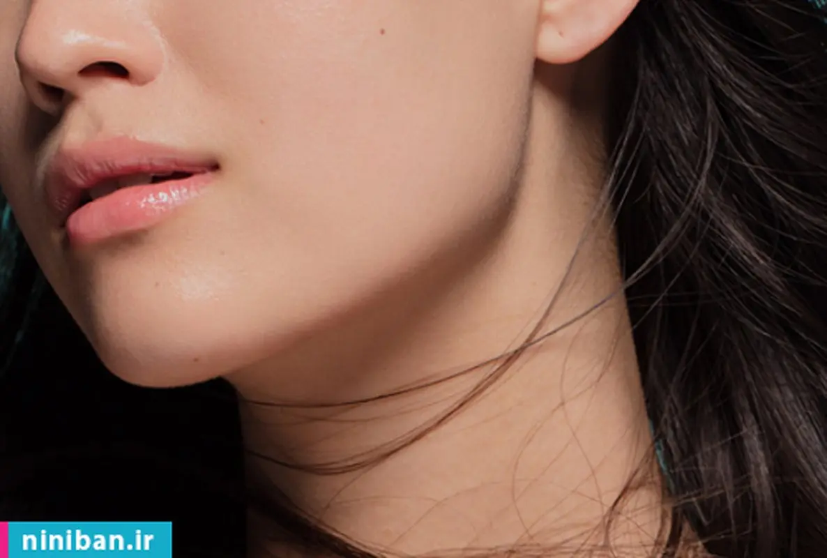 زاویه سازی و فرم دهی فک با تزریق ژل