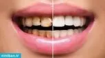 دندانپزشک ترمیمی خوب در تهران چطور پیدا کنم؟