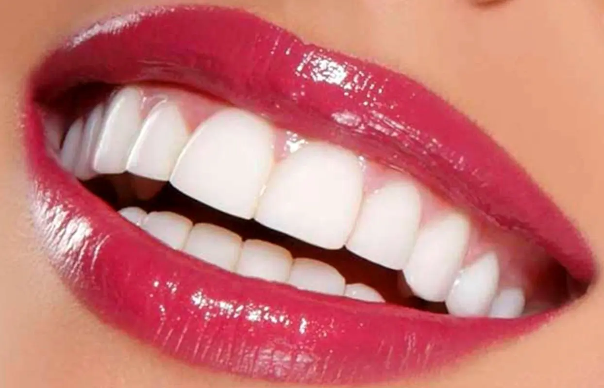 طراحی لبخند زیبا توسط دندانپزشک چگونه است؟