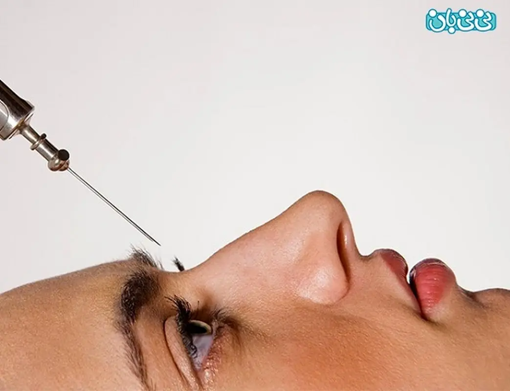 رفع قوز بینی با لیزر، زیبایی را تجربه کنید