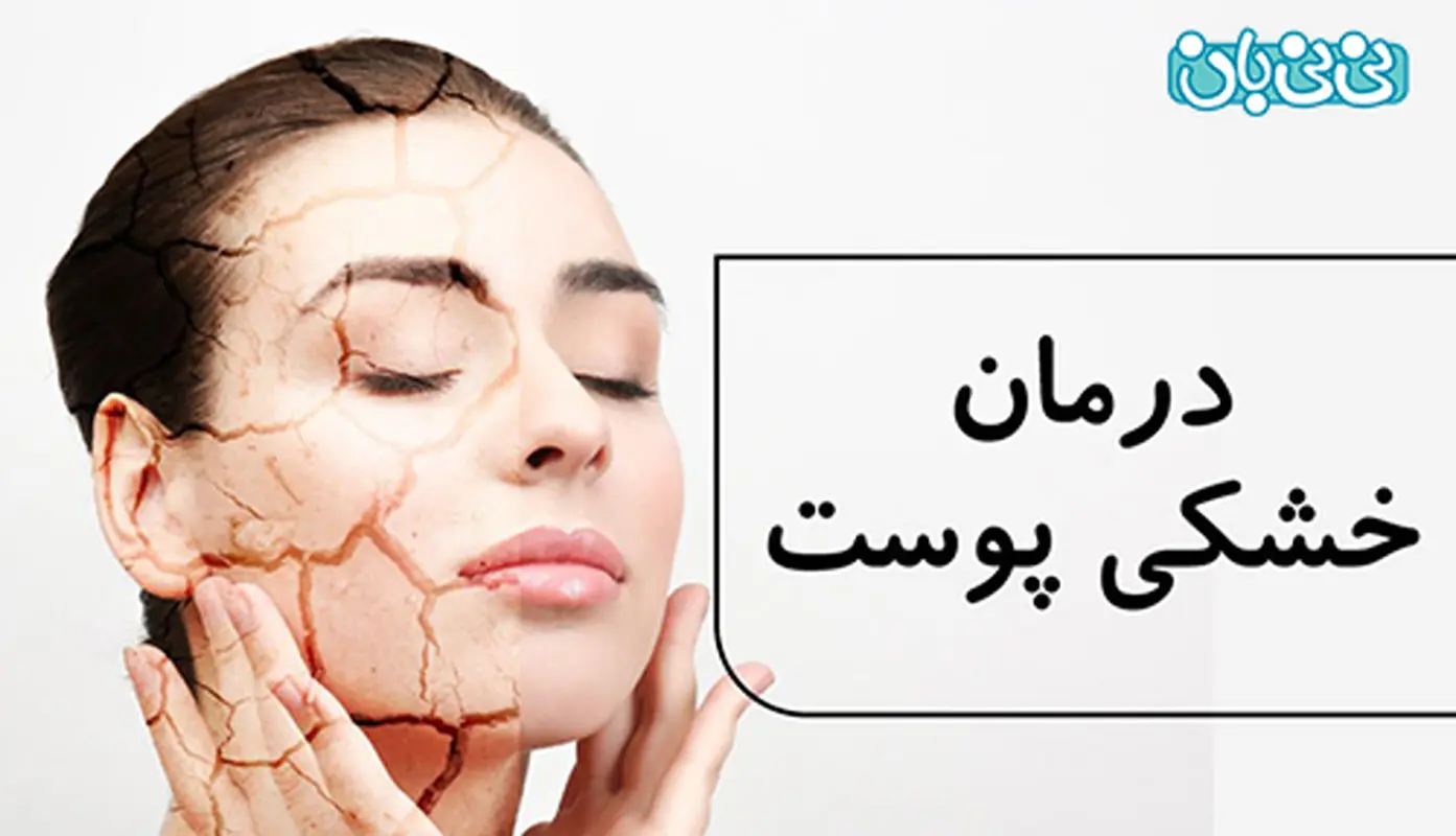 ۱۱ درمان خشکی پوست در زمستان
