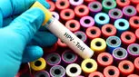 انجام آزمایش HPV، چه نمونه ای مناسب است؟
