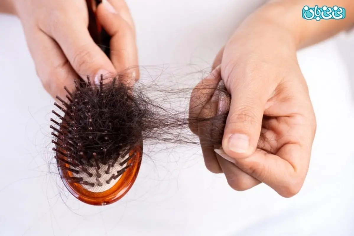 بهترین قرص ویتامین برای ریزش مو چیست؟