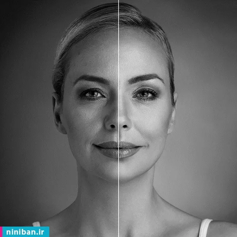 تزریق نانوفت صورت، چیست و چه عوارضی دارد؟