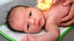 شایع‌ترین مشکلات پوستی در نوزادان و شیرخواران و روش درمان خانگی