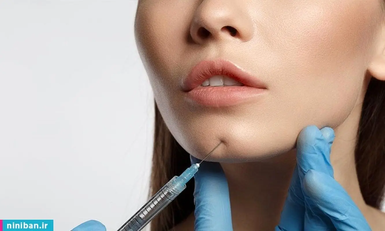 زاویه سازی صورت با تزریق فیلر