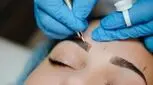 آیا میکروبلیدینگ در بارداری سلامت جنین را به خطر می‌اندازد؟