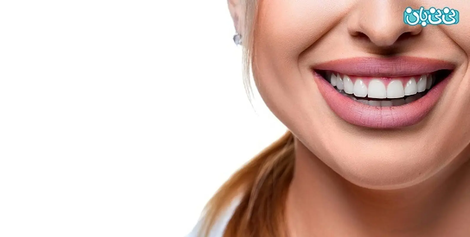 سن مناسب برای ارتودنسی بزرگسالان، تا کی وقت دارم؟