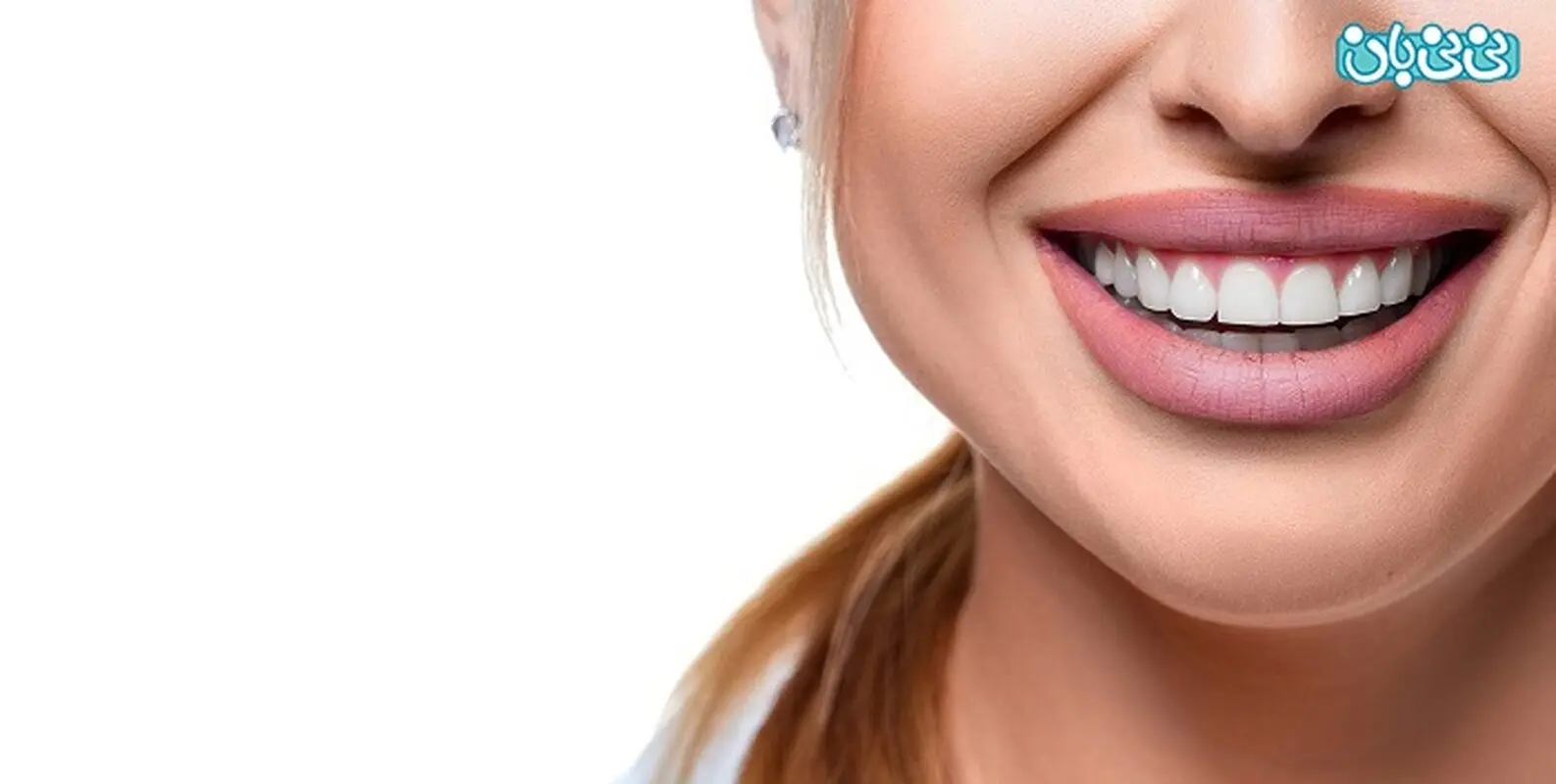 سن مناسب برای ارتودنسی بزرگسالان، تا کی وقت دارم؟