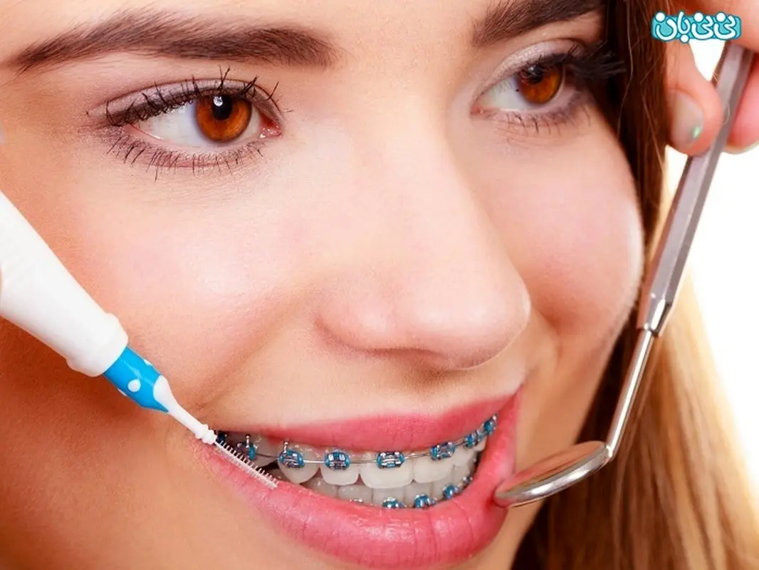تاثیر ارتودنسی بر فک چیست؟ باعث تغییر شکل می‌شود؟