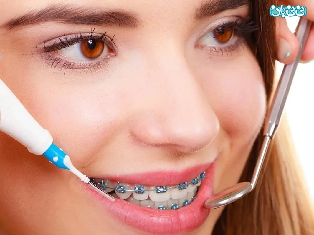 تاثیر ارتودنسی بر فک چیست؟ باعث تغییر شکل می‌شود؟