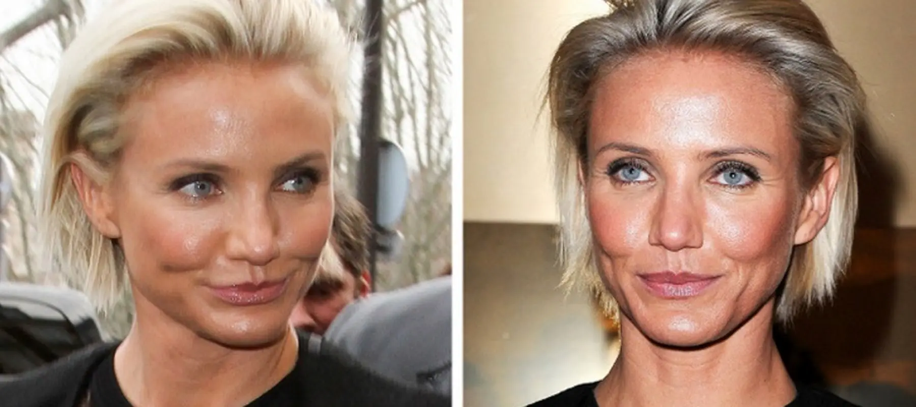 اعترافات ناخوشایند 8 زن مشهور هالیوودی درباره چهره‌شان!