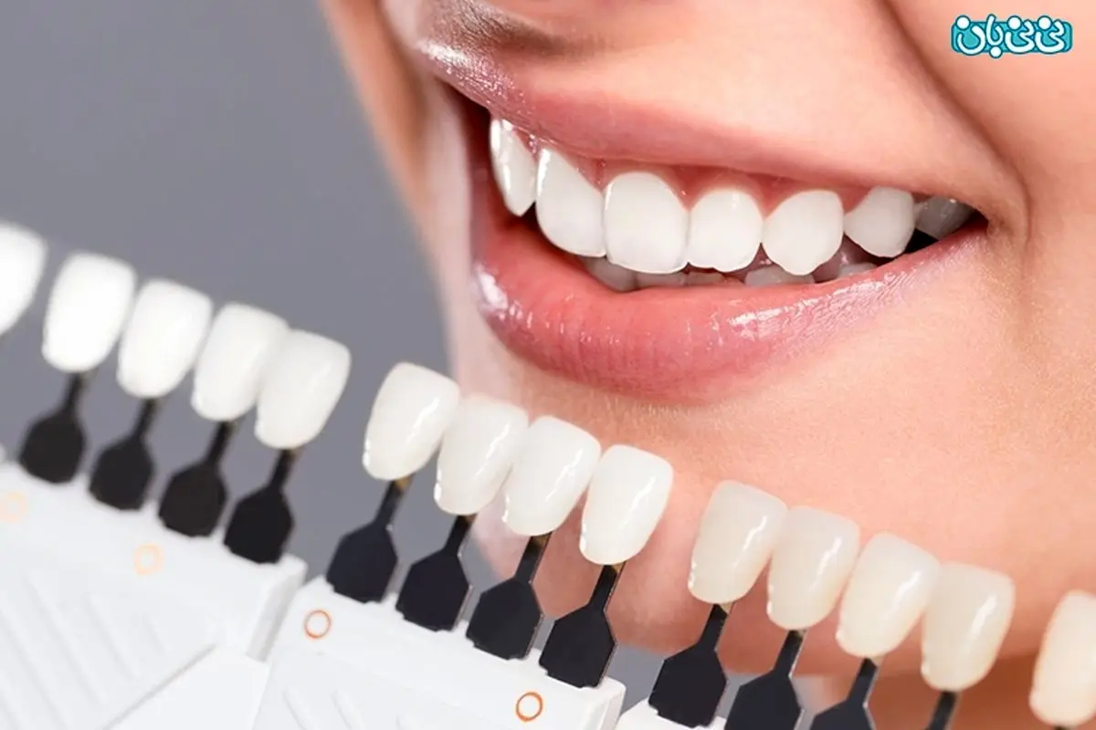 خانم‌های باردار می‌توانند بلیچینگ انجام دهند؟