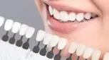 خانم‌های باردار می‌توانند بلیچینگ انجام دهند؟