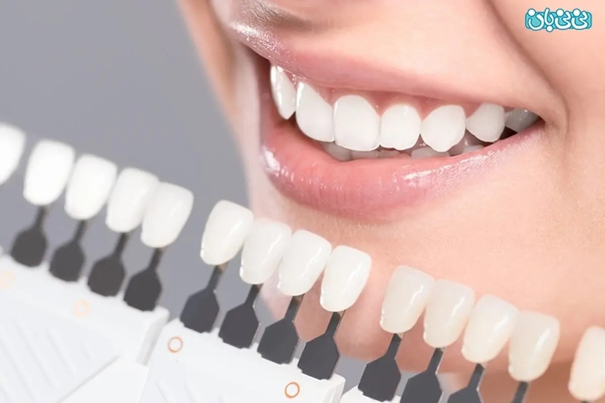 خانم‌های باردار می‌توانند بلیچینگ انجام دهند؟