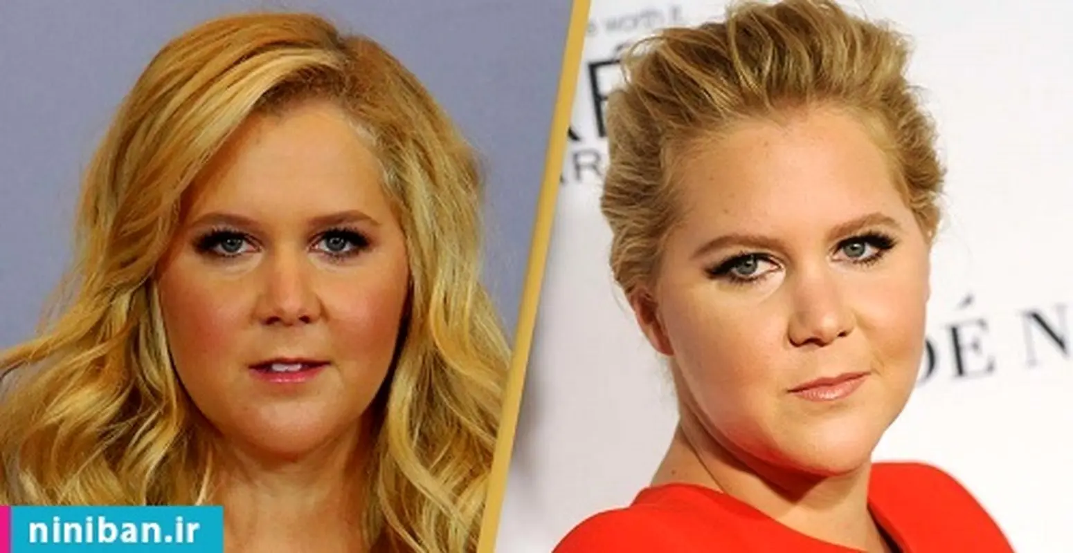 جراحی زیبایی سلبریتی ها، زیبا و بدون نقص