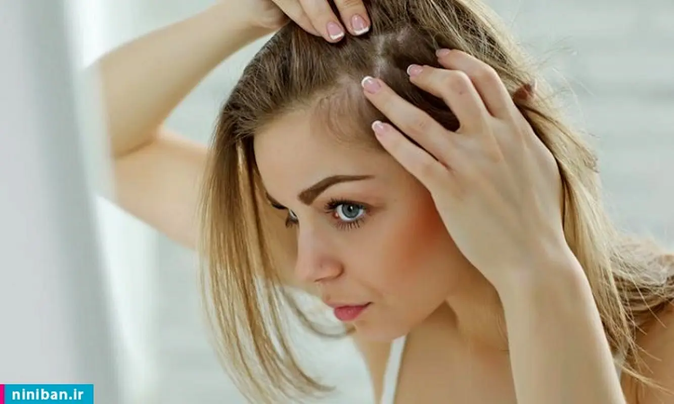 خارش پوست سر و ریزش مو چه دلیلی دارد؟