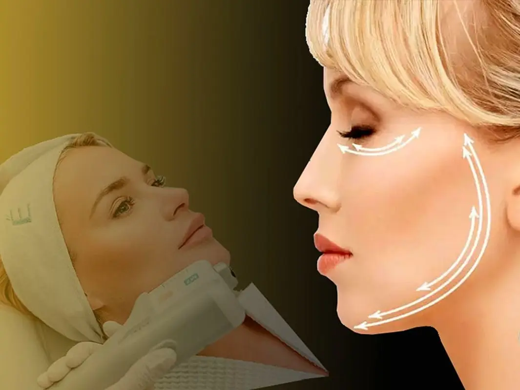 تاثیر هایفوتراپی روی صورت، چقدر است؟