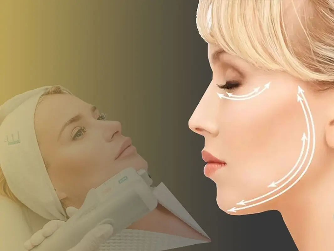 تاثیر هایفوتراپی روی صورت، چقدر است؟