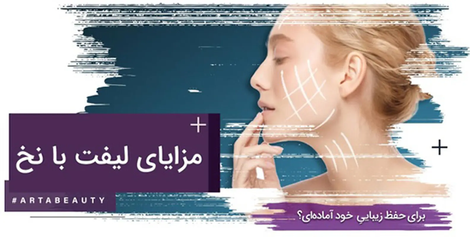 مزایای لیفت با نخ چیست ؟