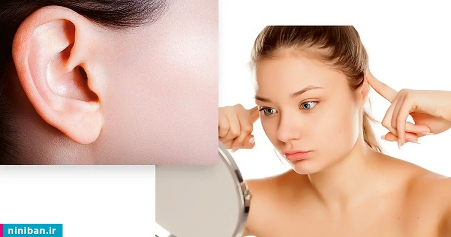 جراحی زیبایی لاله گوش اتوپلاستی چیست؟