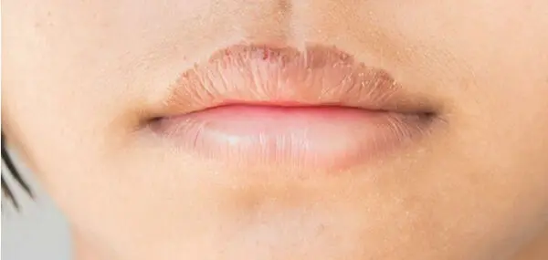 6 روش برای مراقبت از لب و از بین بردن خشکی آن