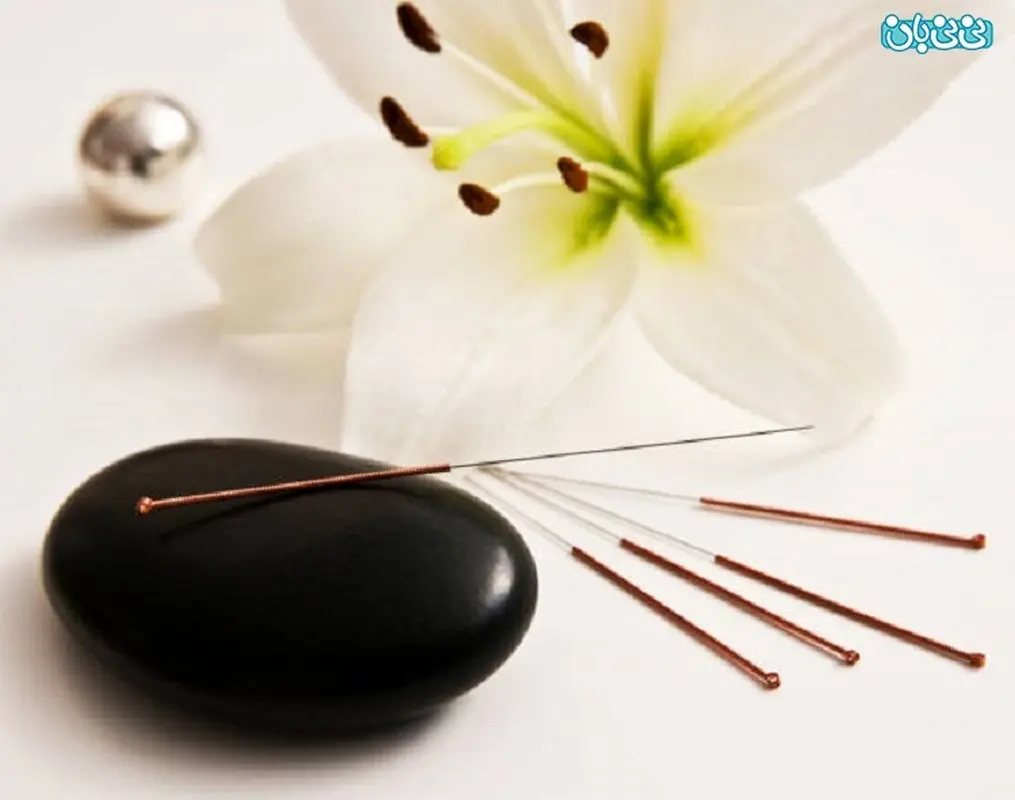 لیفت سینه با طب سوزنی ممکن است؟