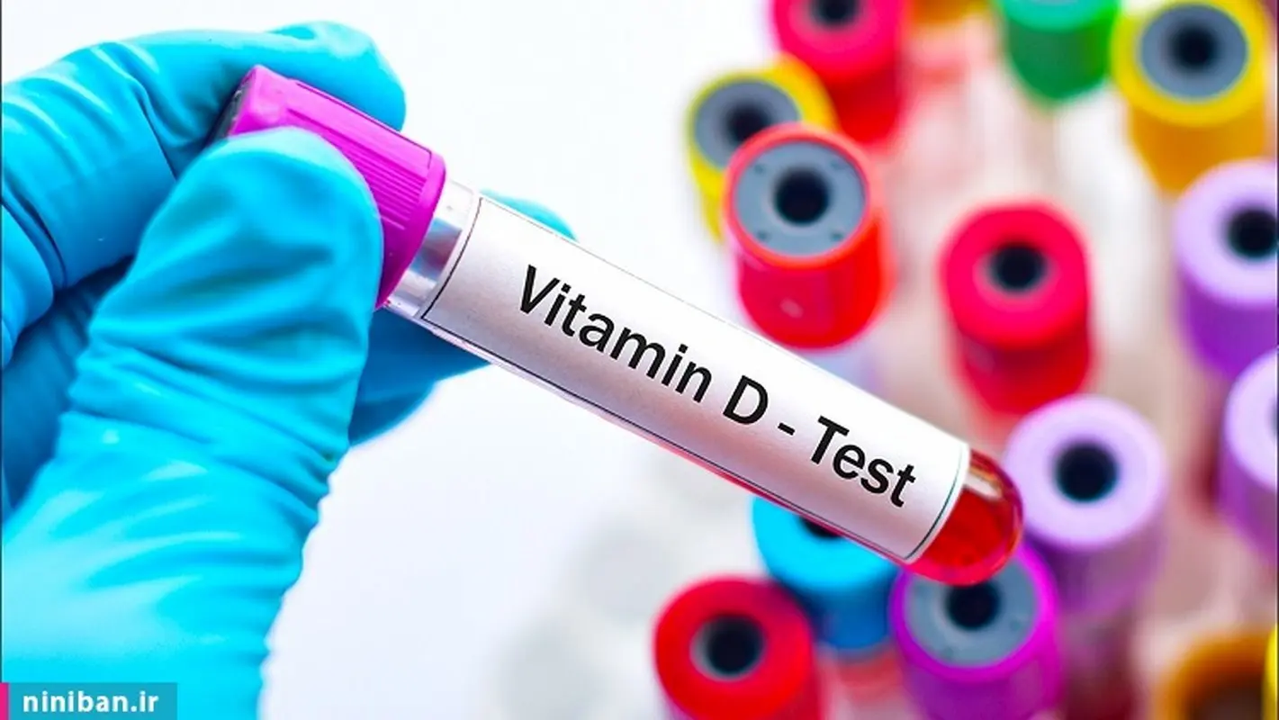 اهمیت انجام آزمایش سالیانه ویتامین D3 چیست؟