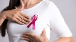 بررسی تمامی روش های درمان سرطان سینه!
