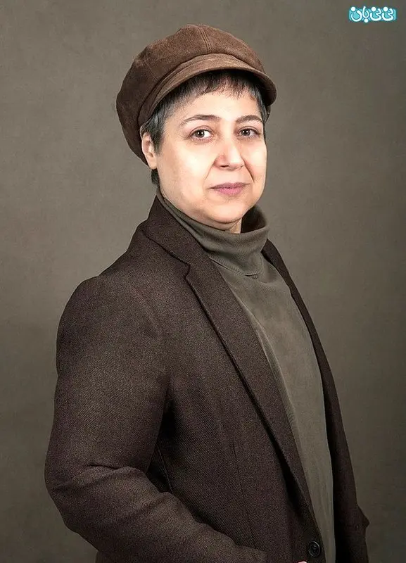 نتایج هورمون تراپی شهره لرستانی برای چهره ای مردانه تر