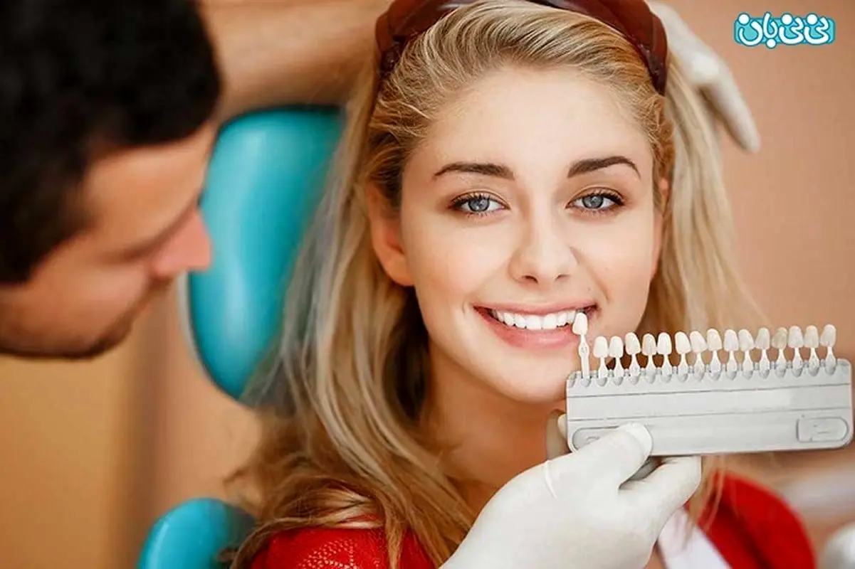 تفاوت روش انجام کامپوزیت ونیر و لمینت، کدام بهتر است؟