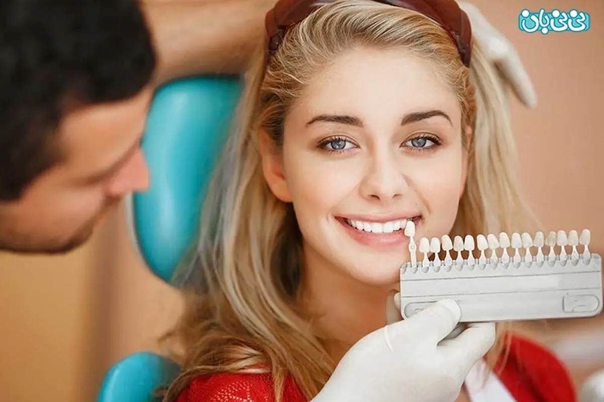 تفاوت روش انجام کامپوزیت ونیر و لمینت، کدام بهتر است؟