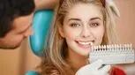 تفاوت روش انجام کامپوزیت ونیر و لمینت، کدام بهتر است؟