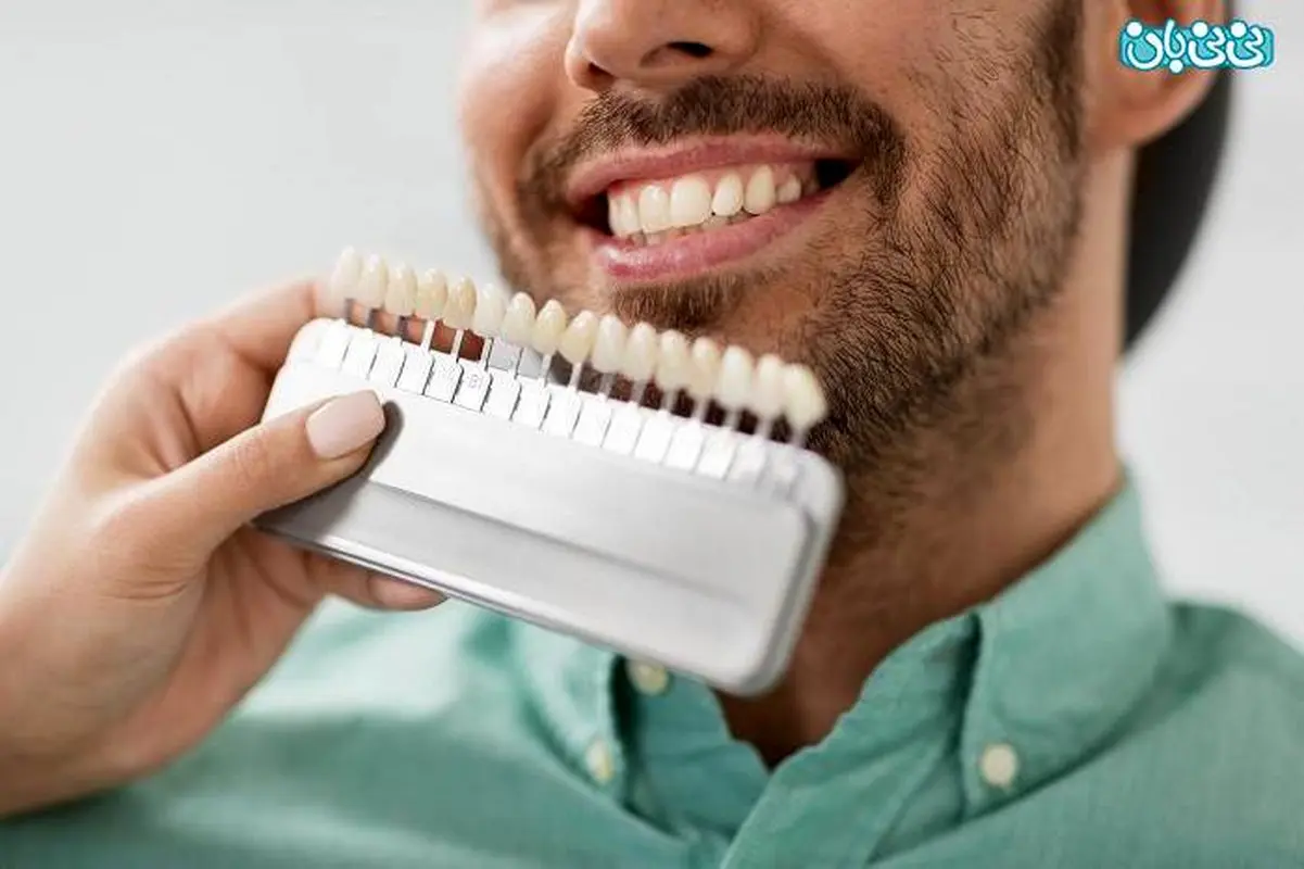کامپوزیت ونیر و لمینت طبیعی، تفاوتها و مزایا و معایب