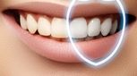 آیا جرم‌گیری به دندان‌ها آسیب می‌رساند؟