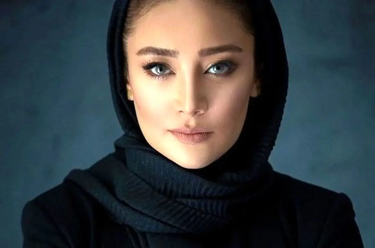 تغییر چهره باورنکردنی خانم بازیگر «شب های مافیا» با عمل زیبایی/ ببین چی بود، چی شد!