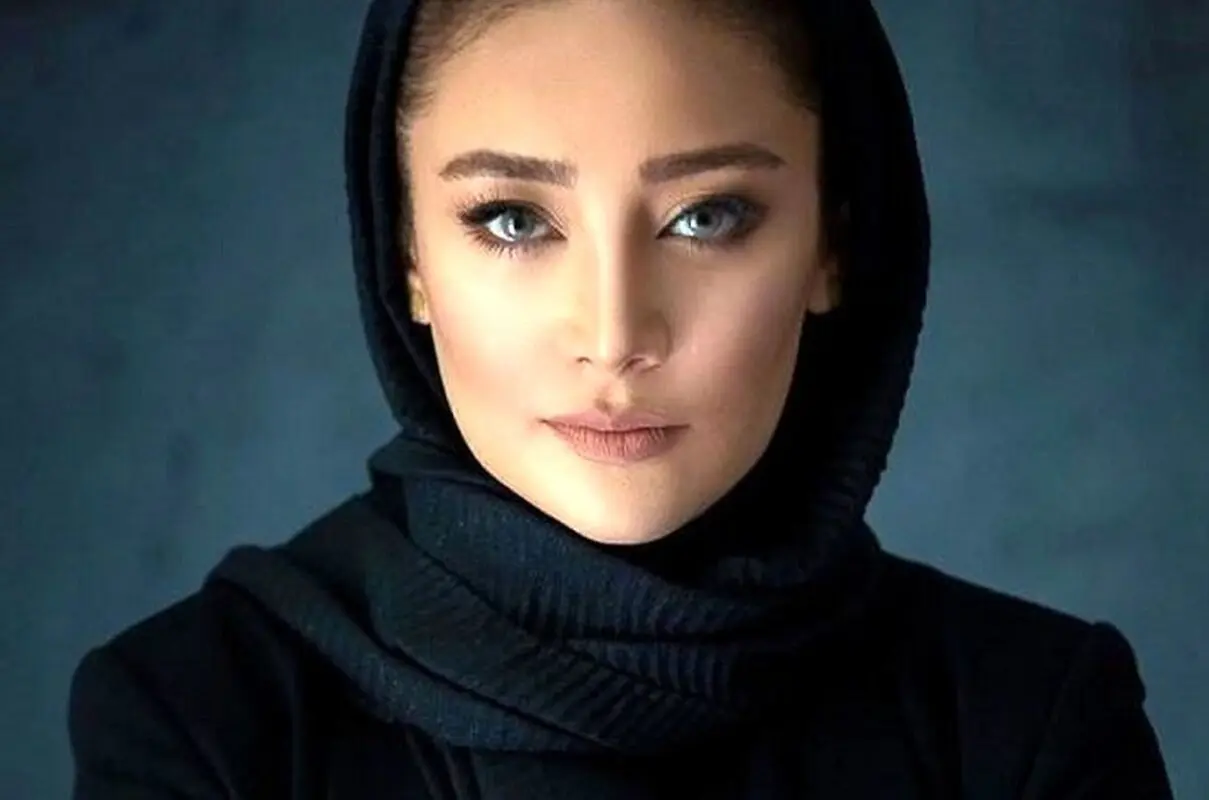 تغییر چهره باورنکردنی خانم بازیگر «شب های مافیا» با عمل زیبایی/ ببین چی بود، چی شد!