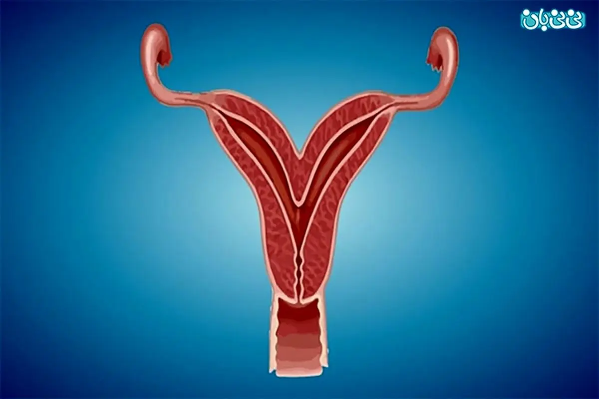 تاثیر رحم دوتایی بر بارداری/ رحم دوتایی و بارداری امکان پذیر است؟