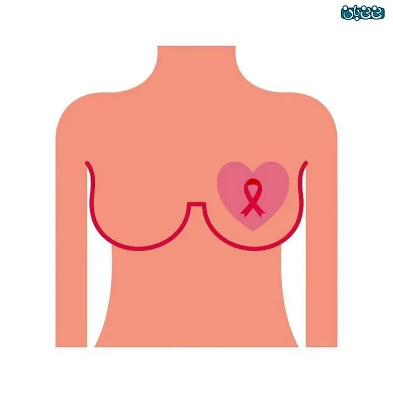 آیا تفاوت پستان چپ و راست در زنان نگران‌کننده است؟