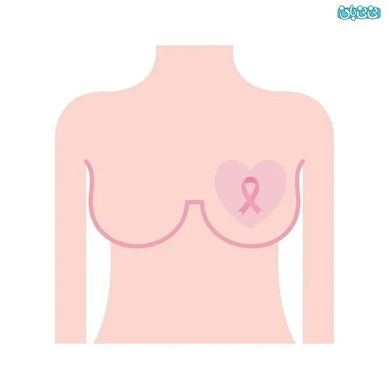 آیا تفاوت پستان چپ و راست در زنان نگران‌کننده است؟