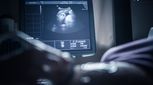 سونوگرافی های تخصصی بارداری: انواع غربالگری ها و کالرداپلرها