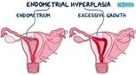 انواع هیپرپلازی اندومتر را بشناسید!